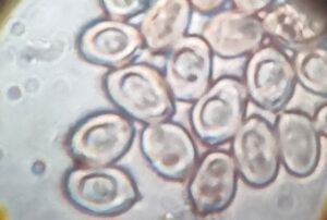 esporas de setas en microscopio